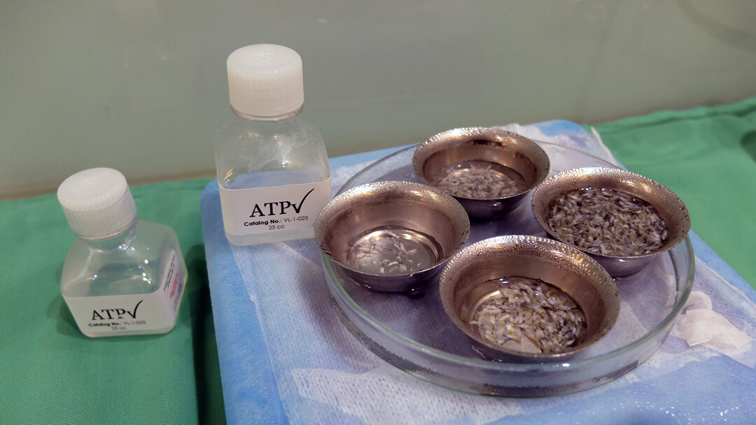 ATP infusion