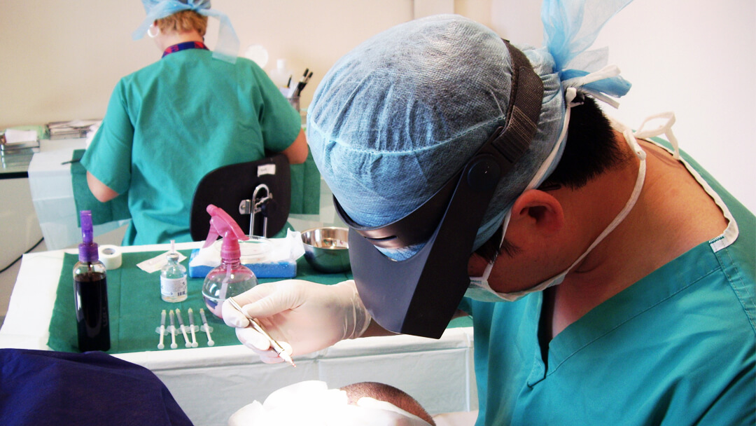 FUE extraction