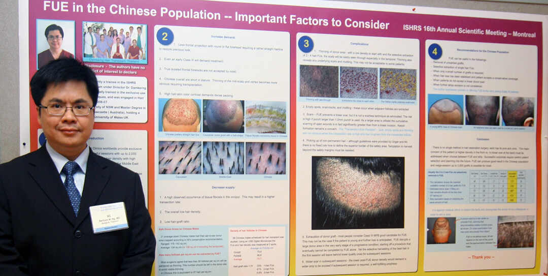 ISHRS presentation 2008