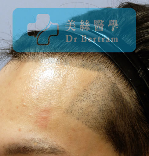 失敗SMP示例