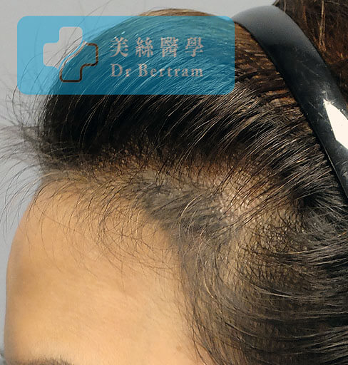 失敗SMP示例